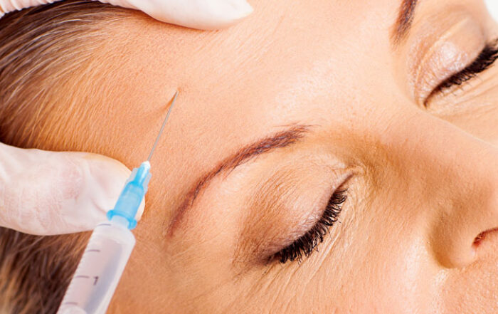 botox-toxina-botulinica