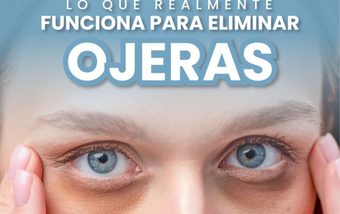 Tratamiento efectivo para ojeras sin cirugía