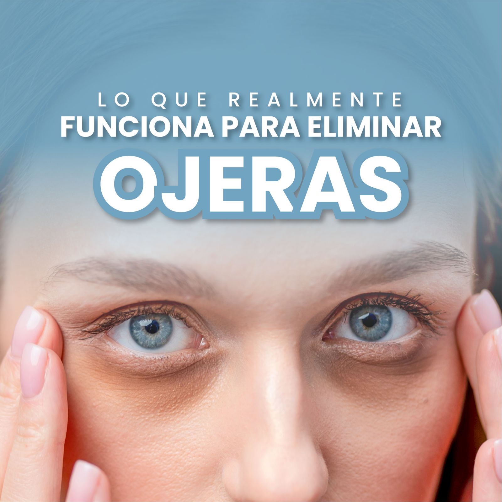 Tratamiento efectivo para ojeras sin cirugía